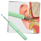 Intelligent Ear Cleaner Stick