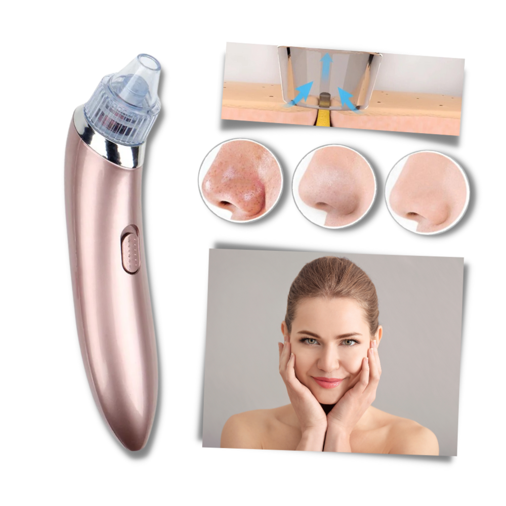 Facial Blackhead Remover Set