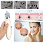 Facial Blackhead Remover Set