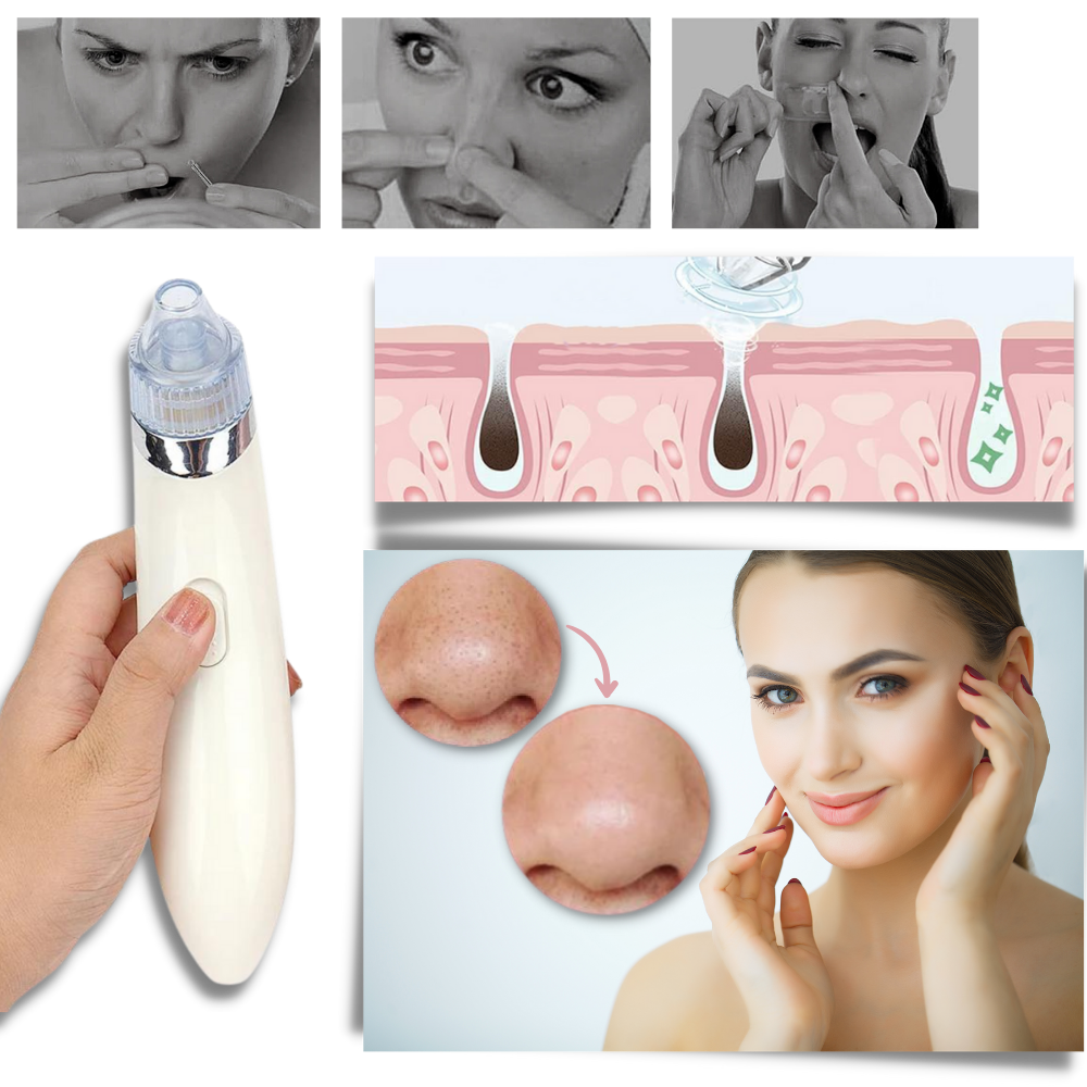 Facial Blackhead Remover Set