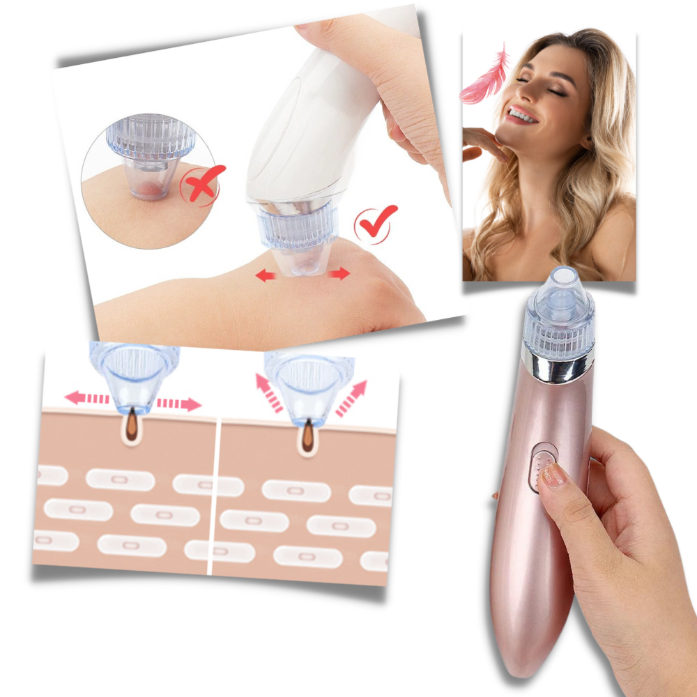 Facial Blackhead Remover Set
