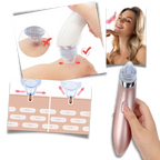 Facial Blackhead Remover Set