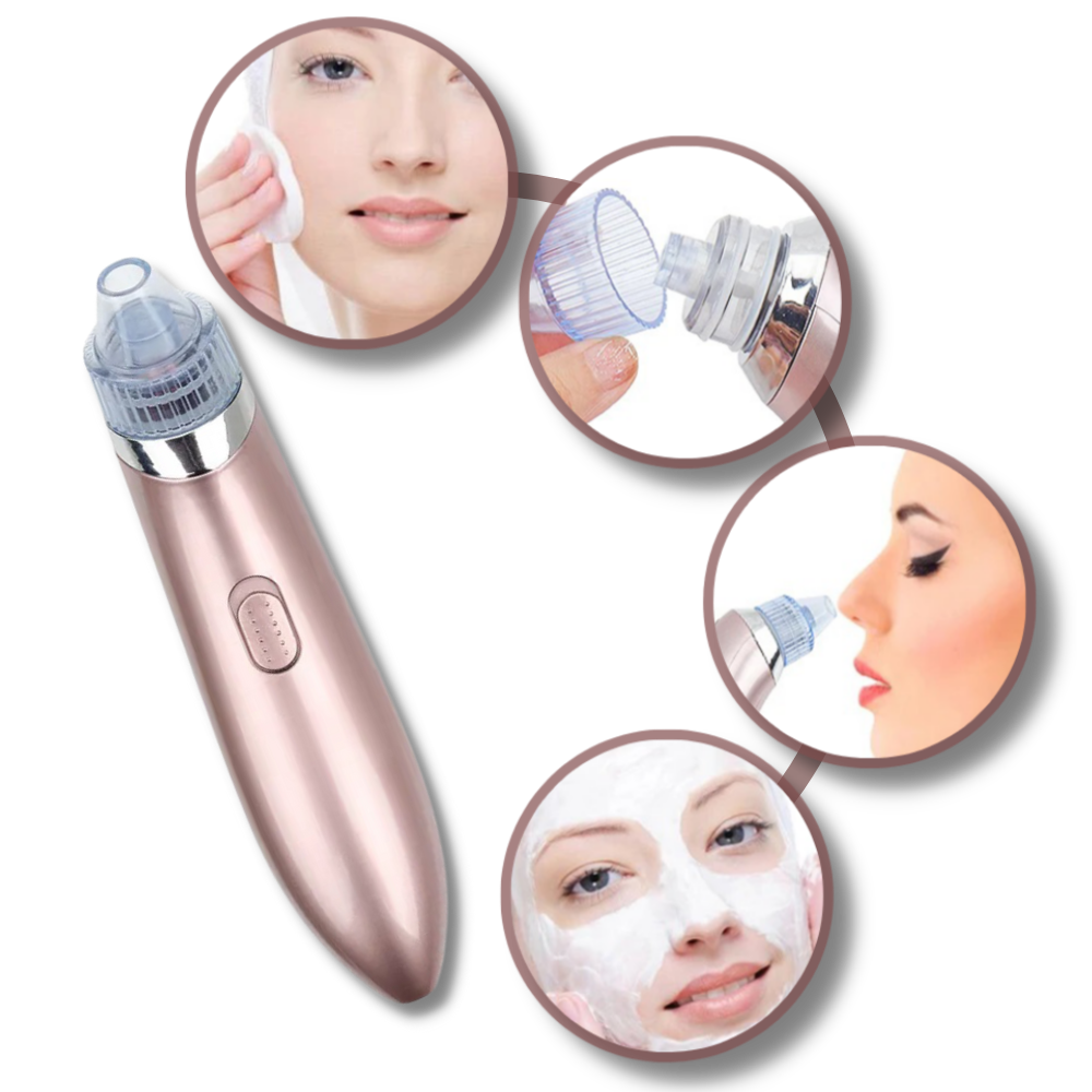 Facial Blackhead Remover Set