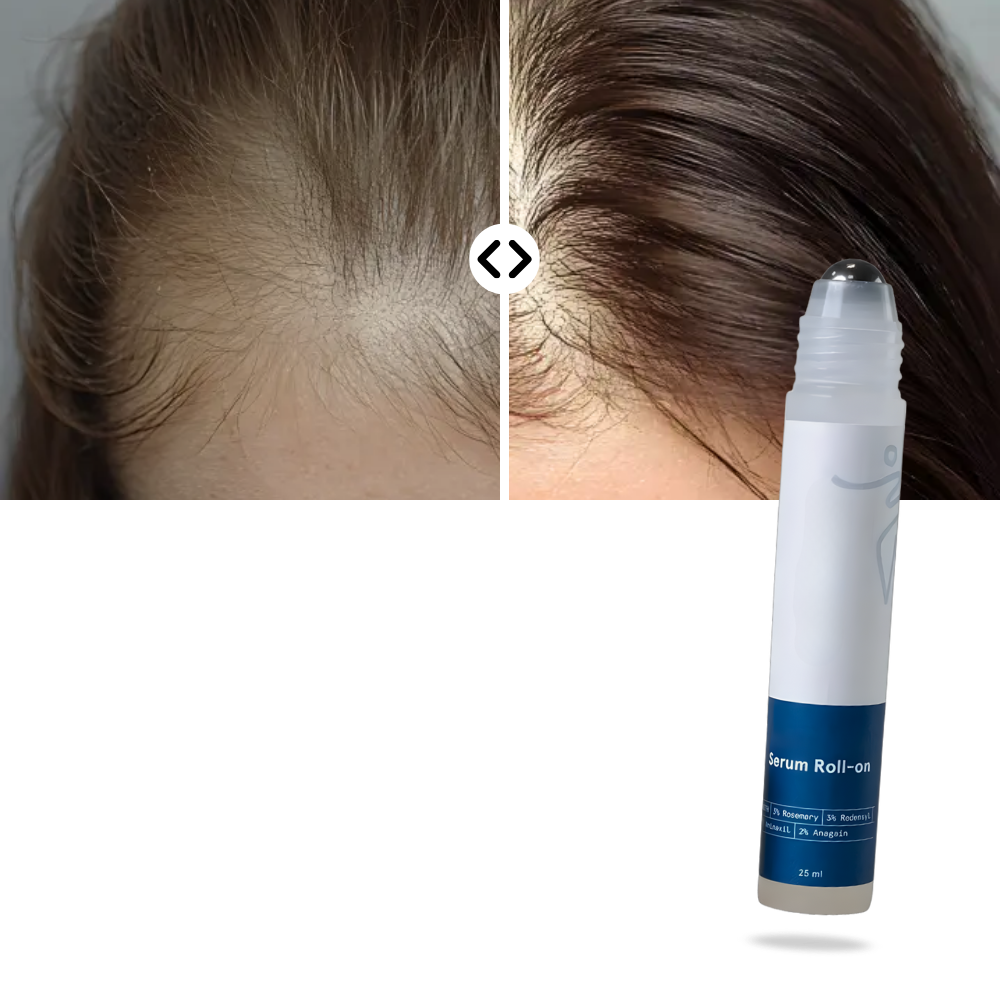 Scalp Nourishing Roll-On Serum