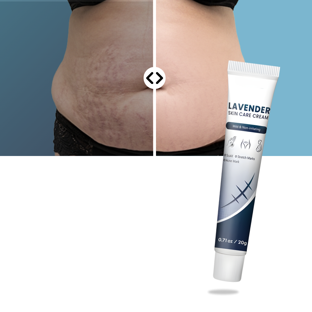 Scar Hydrating Silicone Cream