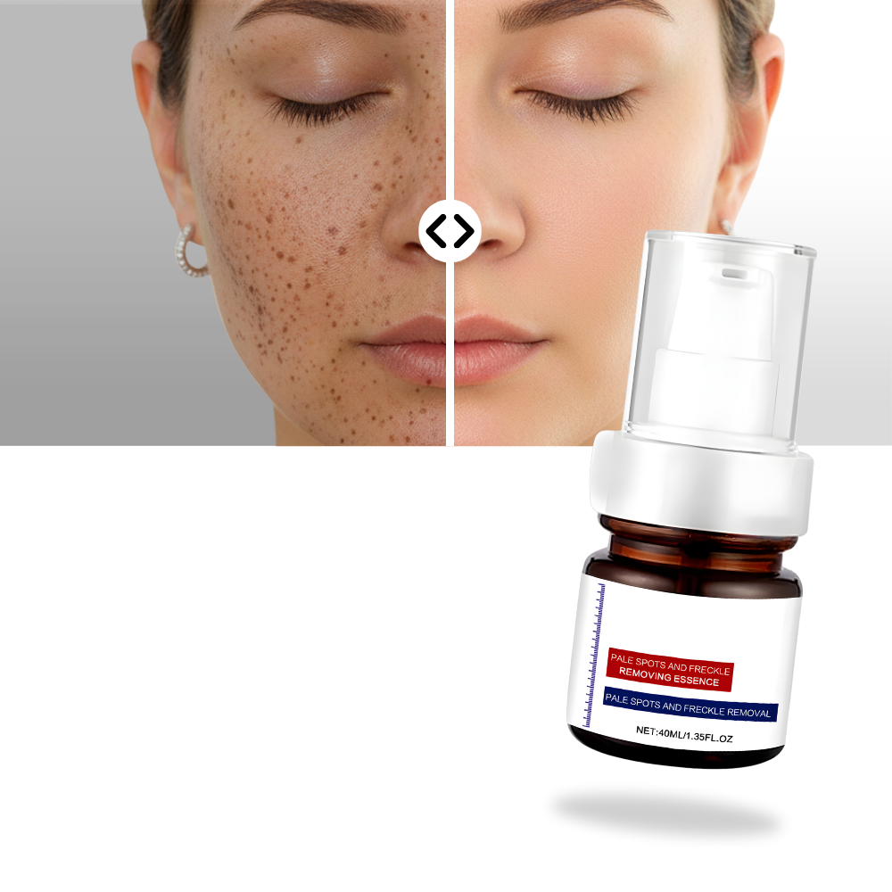 Skin Brightening Silky Kojic Serum